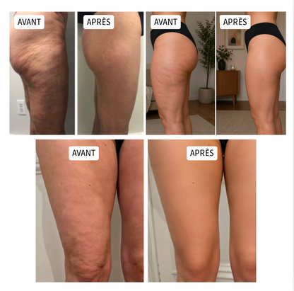 Legging Anti Cellulite 3D